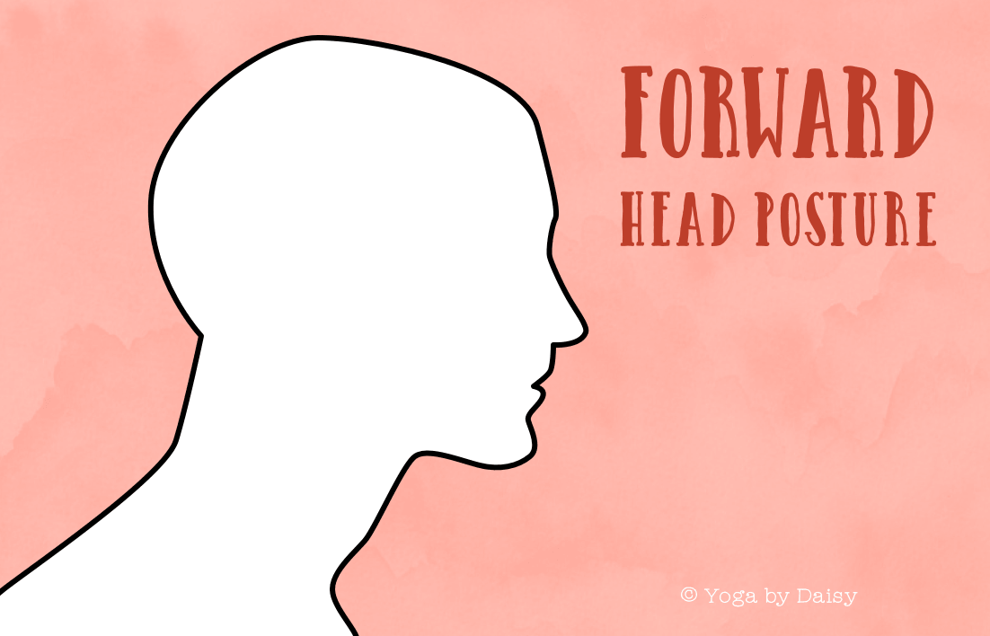 Forward head posture