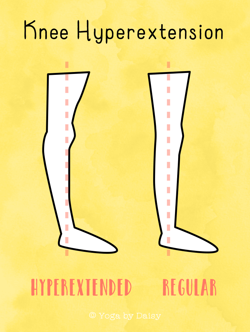 knee hyperextension